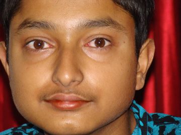 Varun Parmar